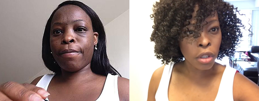 吸脂减肥手术亲身体验,胖女孩瘦身成功后怎么办