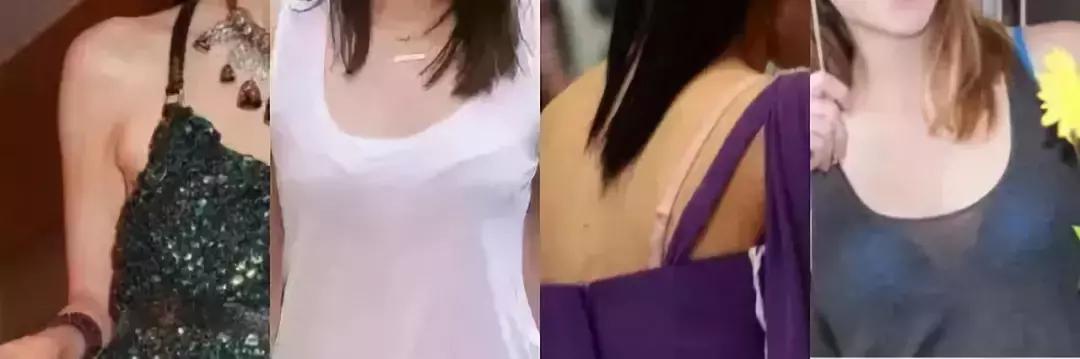 肩带滑落胸前有印子，夏天穿内衣太尴尬，怎么办？