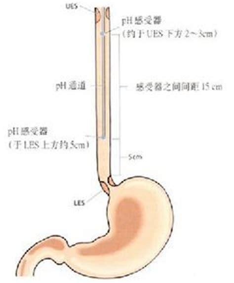 咽干口燥口苦是什么原因吃啥药,咽干口干口苦喉咙有异物感