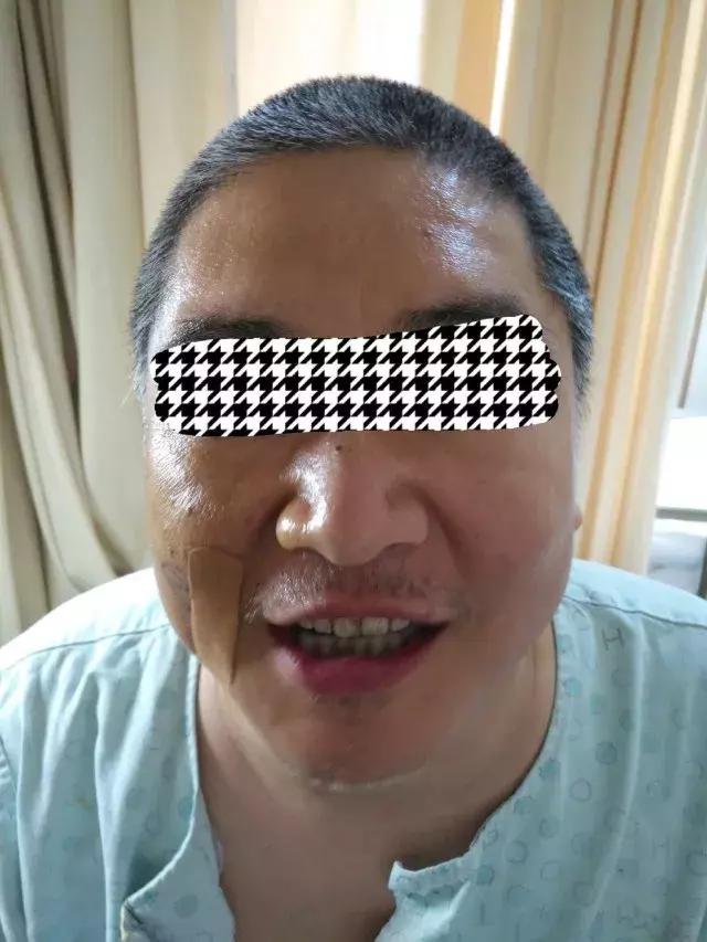 你的脸疼到不想要，神经外科专家却说：“十五分钟就能搞定”