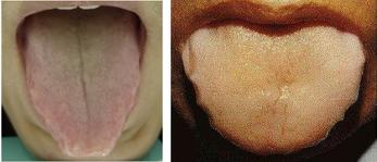 吃饭不消化肚子胀怎么回事,肚子胀不饿怎么治疗