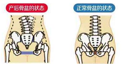 产后怎么快速恢复雌激素,产后肚子赘肉怎么快速恢复