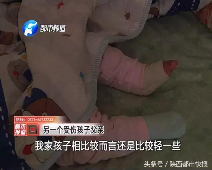 因父亲一时疏忽五岁小女孩截肢,宝宝刚出生就被截肢两只腿都没了