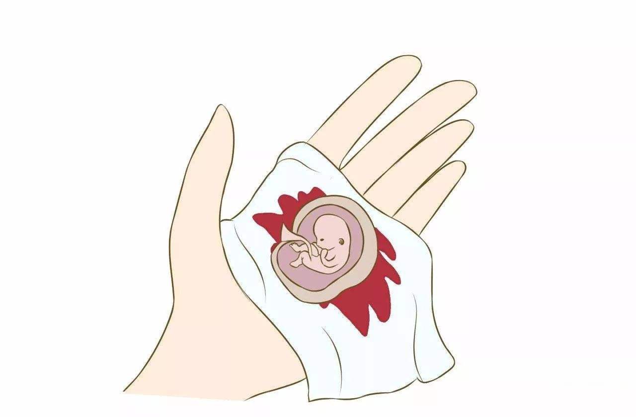 最安全的流产方法是什么,流产的三种类型