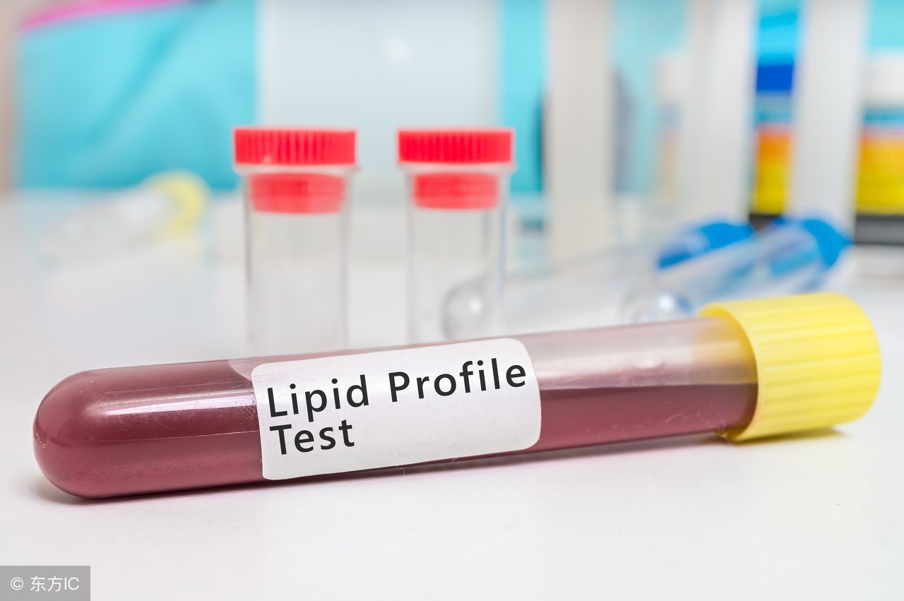 高密度胆固醇和高密度脂蛋白区别,高密度和低密度脂蛋白胆固醇差别