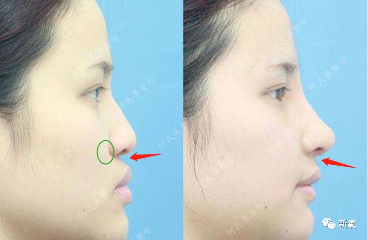 迪丽热巴被p图事件回应,迪丽热巴被p图的视频