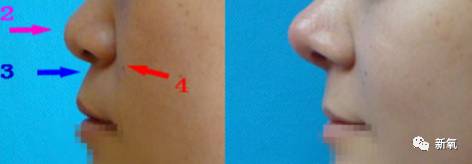 迪丽热巴被p图事件回应,迪丽热巴被p图的视频