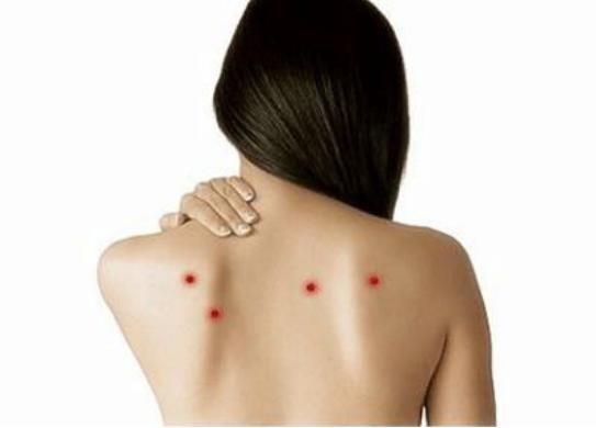 后背长螨虫痘用什么药膏,后背长痘的有效祛痘方法