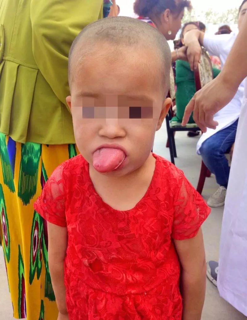 爱撒南疆热土深汗滴墨玉永恒情王文杰医生援疆三个月了