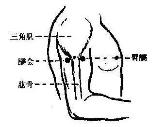 肩周炎冻结肩能治愈吗,肩周炎冻结肩锻炼视频
