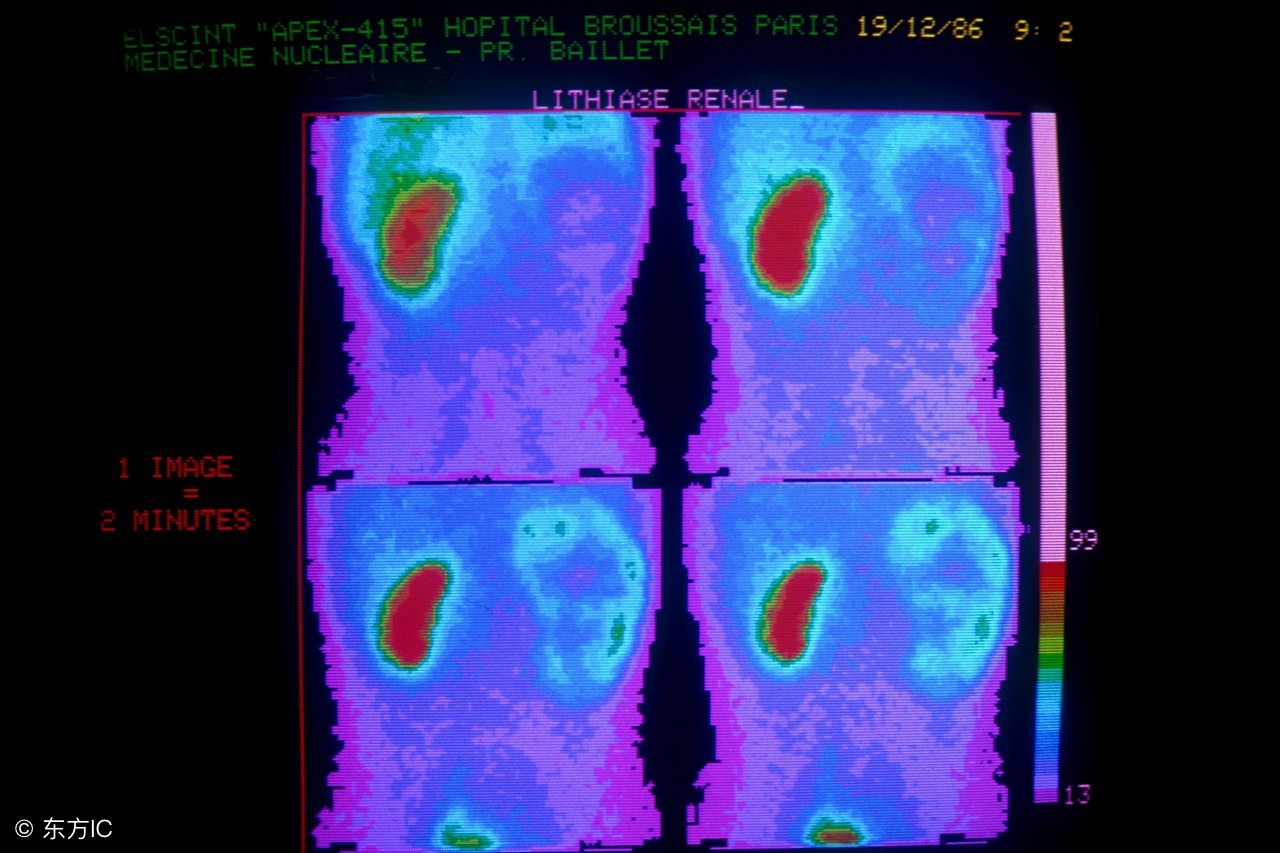 出现尿痛是什么原因引起的,出现血尿说明尿路感染严重吗