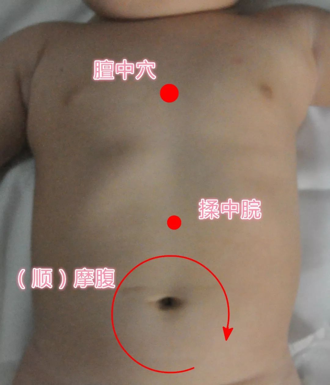 小儿推拿贴敷配方大全,小儿推拿如何学会配穴