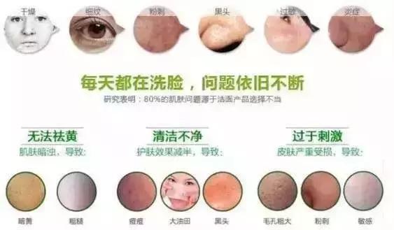 用了那么多清洁面膜还是有黑头,科颜氏清洁面膜脸干