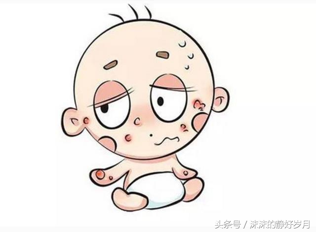 宝宝螨虫怎么消除,螨虫对儿童有哪些危害动画