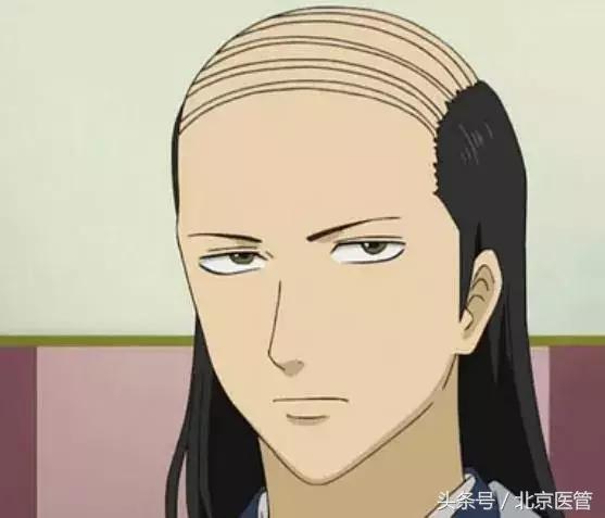 每5名男士就有一人中招？快帮爸爸解决这件“头顶大事”！