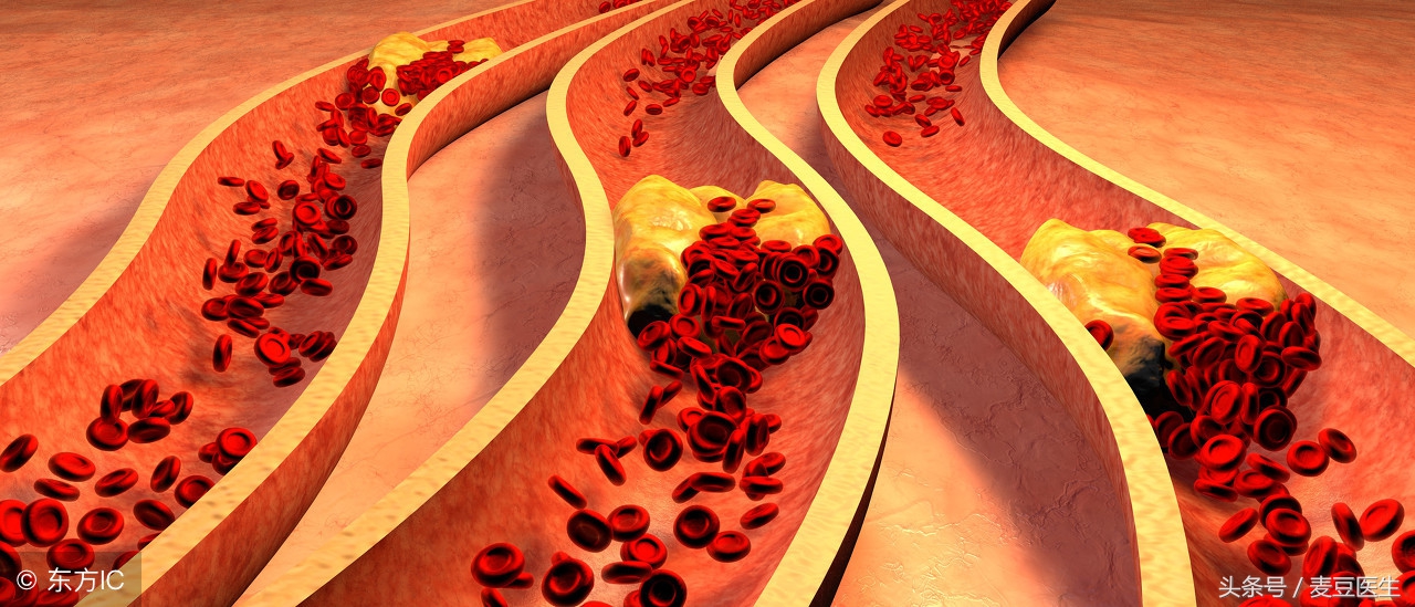 胸闷是血管堵了吗,胸闷气短手指神经刺痛