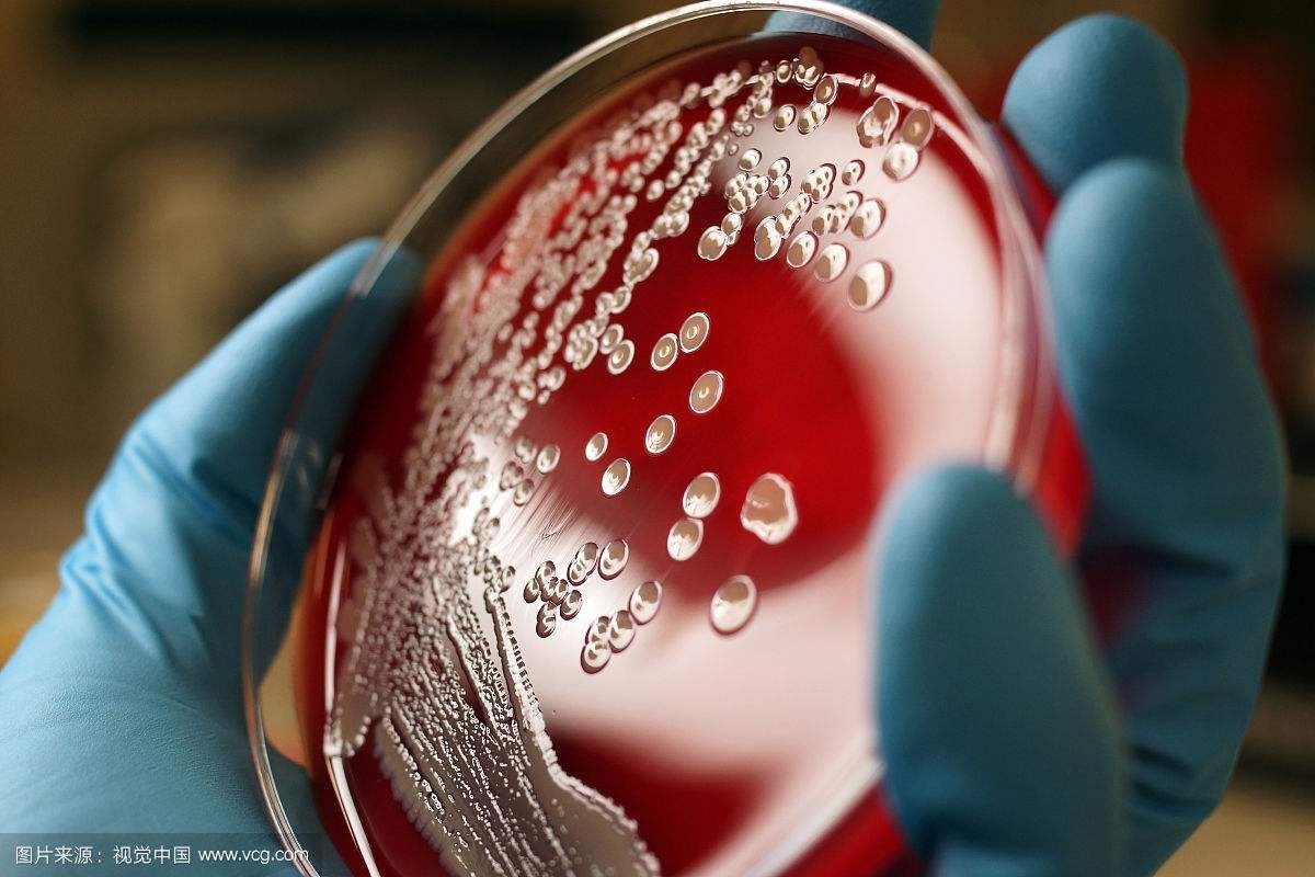 女子穿高跟鞋被吓到摔倒鞋子掉了,女人穿高跟鞋脚磨破一大块皮