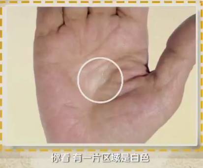 手的健康识别,手型看健康