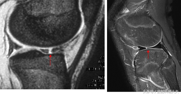 直观感受一下足球的爆发力,看了足球才知道足球的魅力