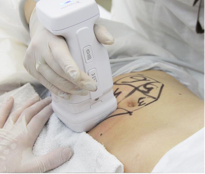 瘦身不瘦脸的运动,躺着就能瘦的神奇瘦身法