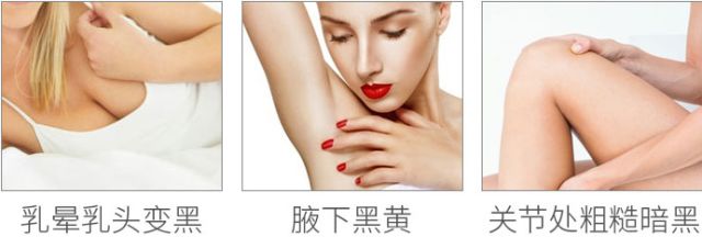 PP、腋下、手肘、三角区发黑暗沉？日本女*爱性**用好物，抹一抹，4周白嫩如少女！