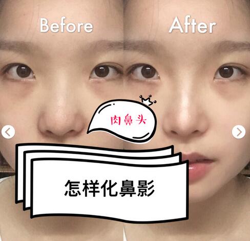 真肉鼻子分享亲测有效的鼻阴影方法