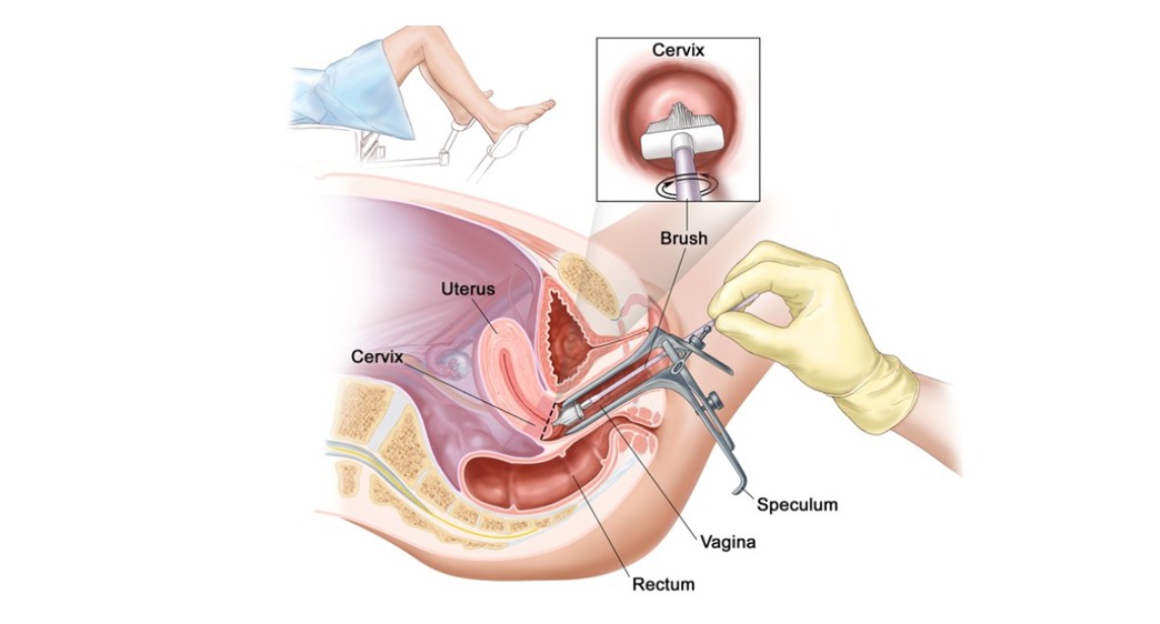 治疗hpv的药目前有哪些,治疗hpv的常用药有什么