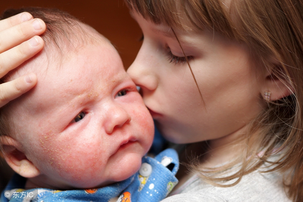 新生儿手脚皮肤干燥脱皮,新生儿皮肤干燥脱皮是什么原因