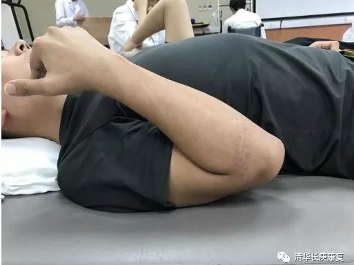 肌腱损伤的指南,长庚肌腱损伤康复训练