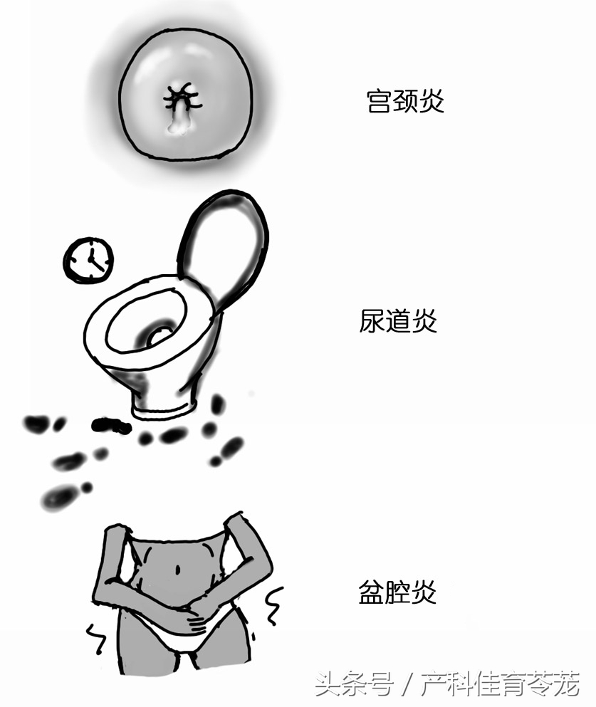 沙眼衣原体阳性是什么原因导致的,发病率最高的性传播疾病