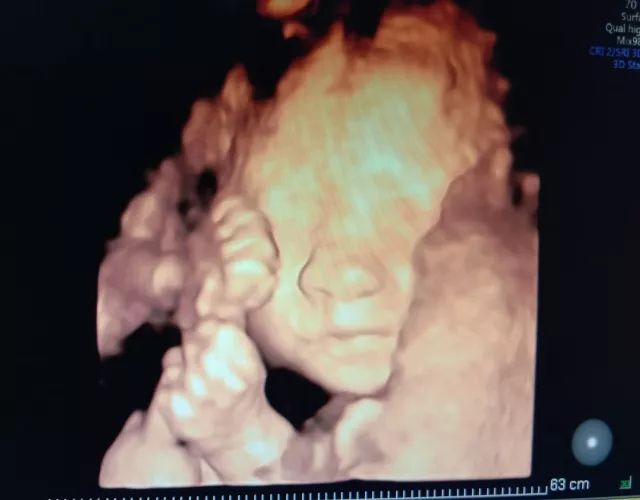 关于超声检查的问题,科普答疑