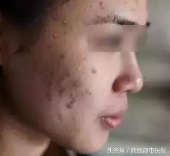 你的面膜上黑榜,用不好的面膜真的会烂脸吗