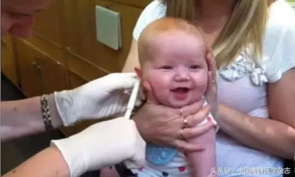 手术联合放疗治疗瘢痕疙瘩,耳廓瘢痕疙瘩切除手术后耳朵化脓