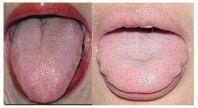 肾阴虚和肾阳虚有怎样的症状,肾阴虚和肾阳虚都有怎样的症状