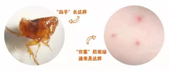 蚊虫咬了小宝宝,蚊虫咬了儿童用什么药