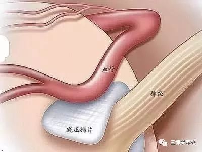 眼皮跳个不停怎么回事,眼皮一直跳当心什么疾病