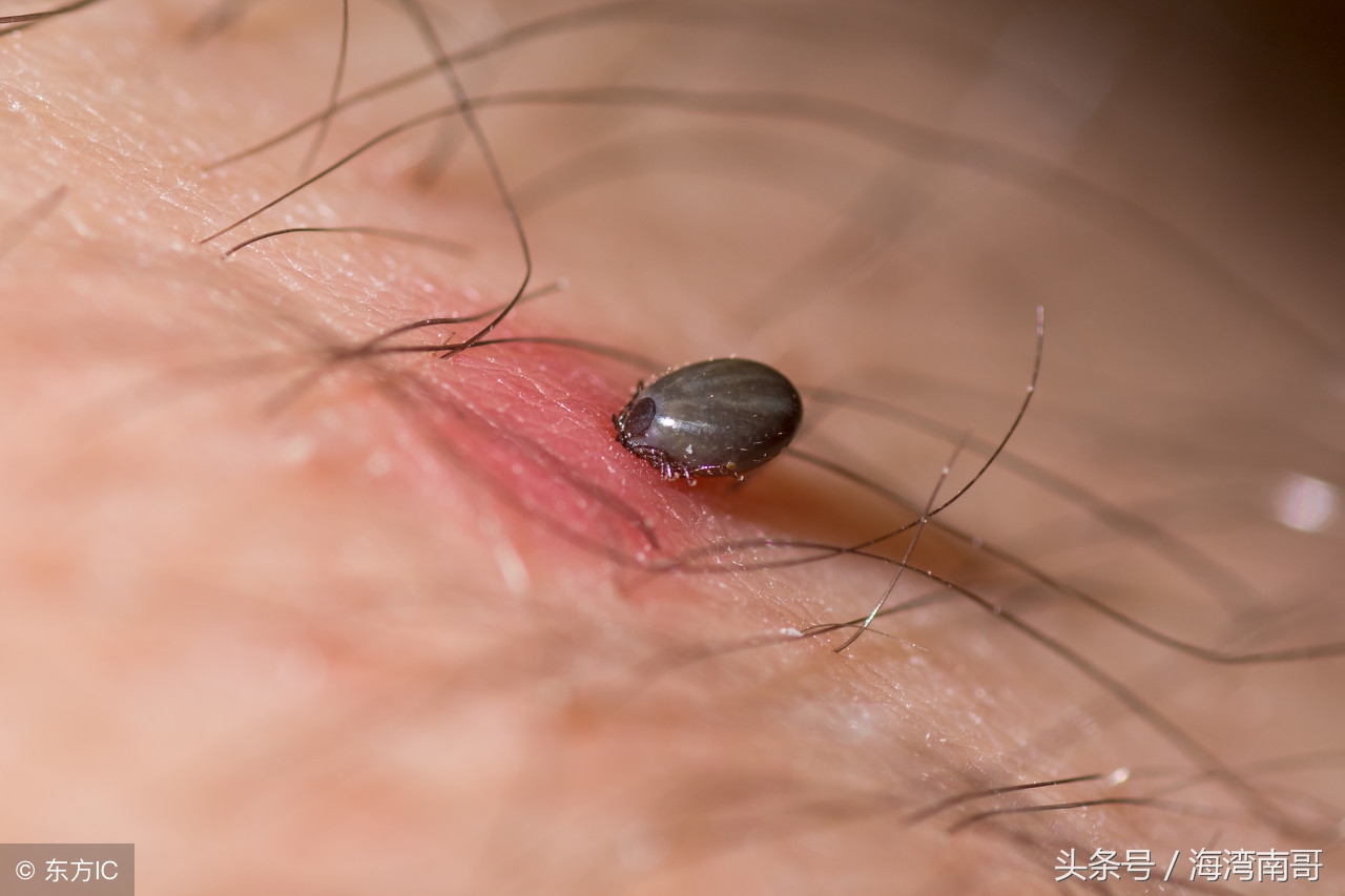 牛被蜱虫咬后怎么治疗,很小的牛蜱虫咬人拔了之后怎么办