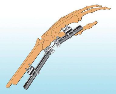 丹麦中场受伤视频,丹麦球员怎么受伤的欧洲杯
