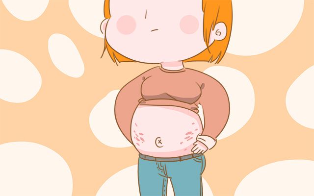 小孩肚子有萎缩纹,儿童皮肤出现萎缩纹