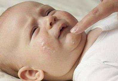 治疗宝宝湿疹比较好的药膏,治疗宝宝湿疹最好的中医院