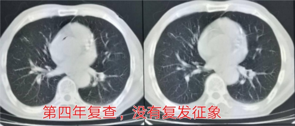 除了靶向免疫还有别的方法吗,除了靶向药还有什么方法治疗