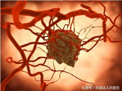 放疗后饮食上应该注意什么,放疗过程中的饮食