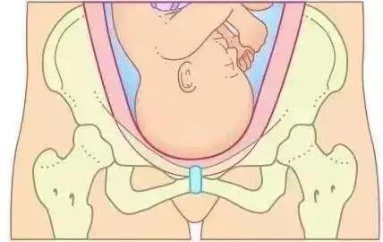 一胎盆底肌松弛二胎能锻炼好吗,一胎用的盆底肌仪器二胎还能用吗