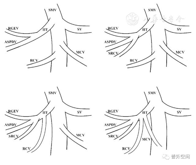 腹腔镜右半结肠癌手术步骤,腹腔镜右半结肠癌