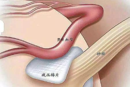 脸偶尔针扎一样疼一下,三叉神经痛脸痛在中医上怎么讲