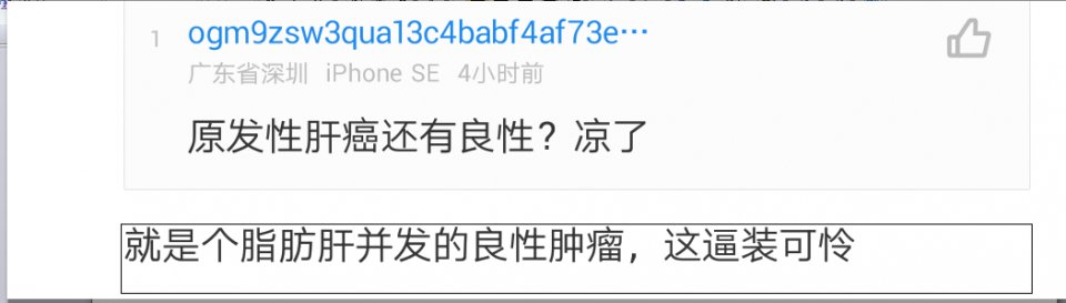 骚猪“烧猪”？女友确认PDD肝癌网友：脂肪并发太胖！