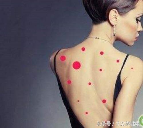 背上长痘的解决办法,背上长痘的原因和治疗方法