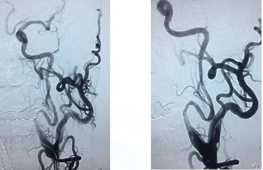 心血管内科急救流程,急诊静脉用药方法