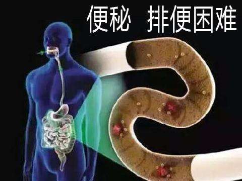 中医诊断学——“观大便,识健康”