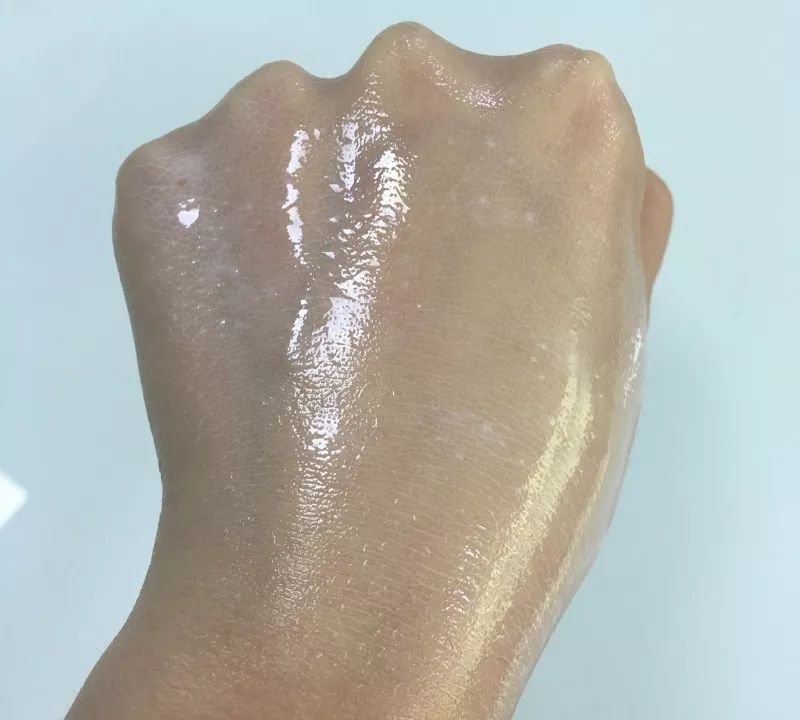 特别多的黑头毛孔也特别大怎么办,黑头最烦人的问题